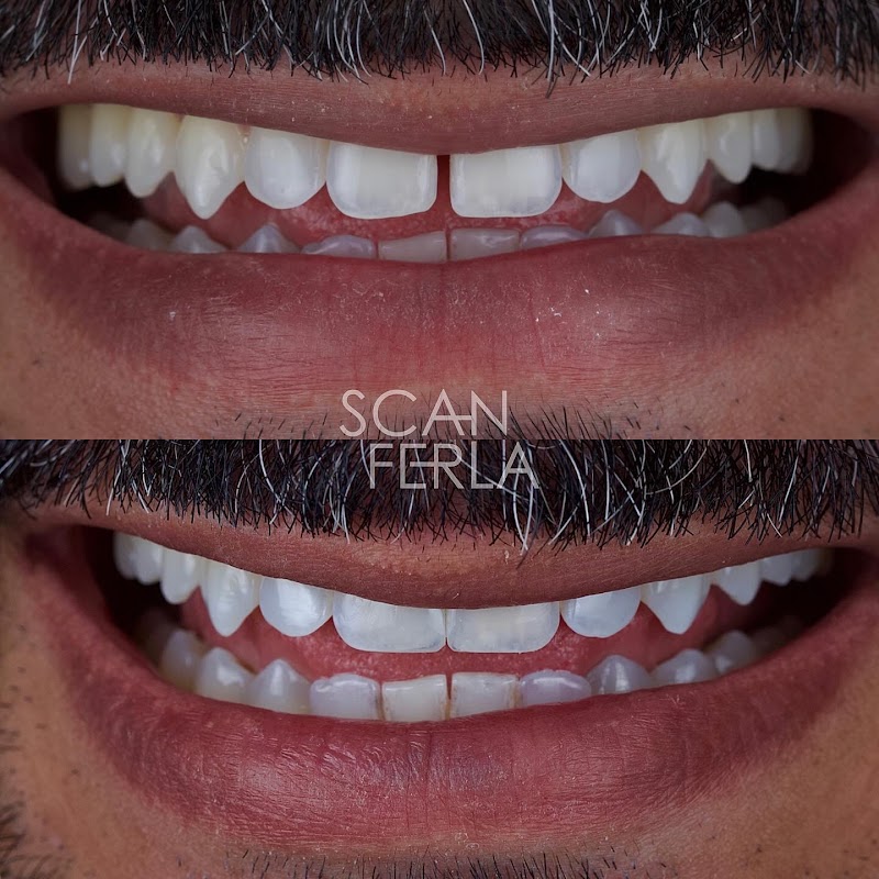 Scanferla Odontologia - Dentista | Prótese | implantes | Facetas | Alinhador invisível | Botafogo - foto 2