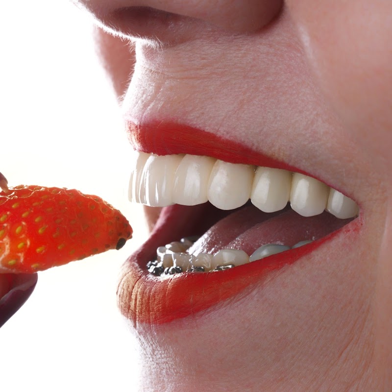 Scanferla Odontologia - Dentista | Prótese | implantes | Facetas | Alinhador invisível | Botafogo - foto 5