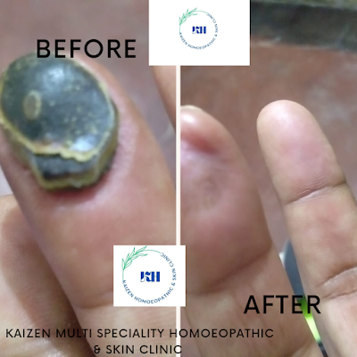 KAIZEN MULTI SPECIALITY HOMOEOPATHIC & SKIN CLINIC - Image 3