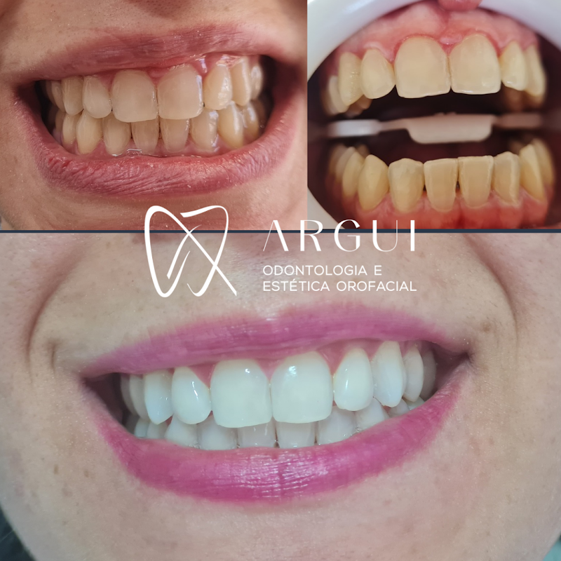 Argui Odontologia - Implantes, Facetas Dentárias e Ortodontia na Asa Sul, Brasília - foto 2