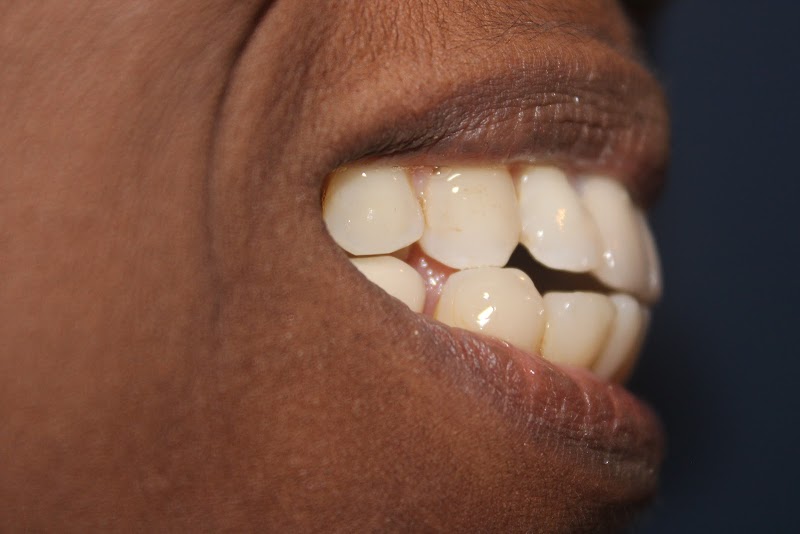 Dentista Baiano - Especialista em Implantes Dentários em Salvador - foto 4