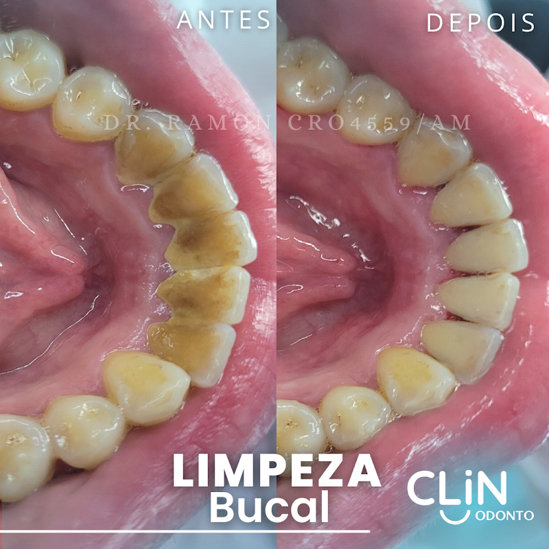 CLIN ODONTO - Clinica Odontológica - foto 4