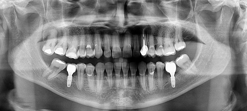 Walter Almeida Implantes Belém - foto 2