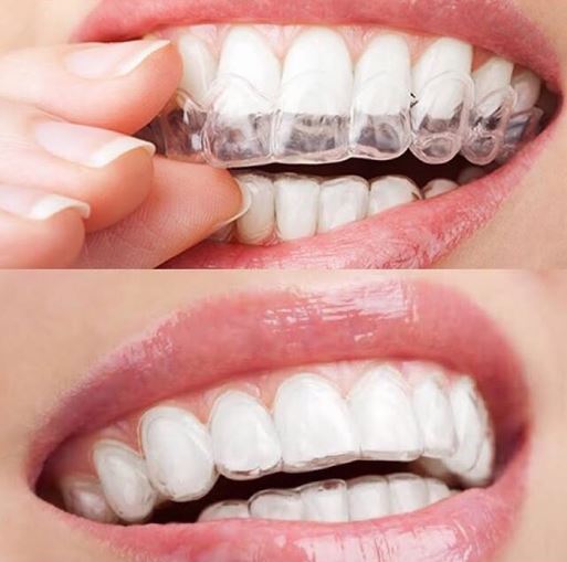 Valéria Meneli Odontologia - foto 4