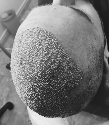 Bayraklı Saç Ekim Merkezi - İzmir Eges Hair Transplant logo