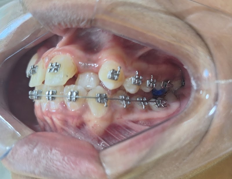 Dra. Daniela Dantas DENTISTA Ortodontia e Protese Dentária - foto 4