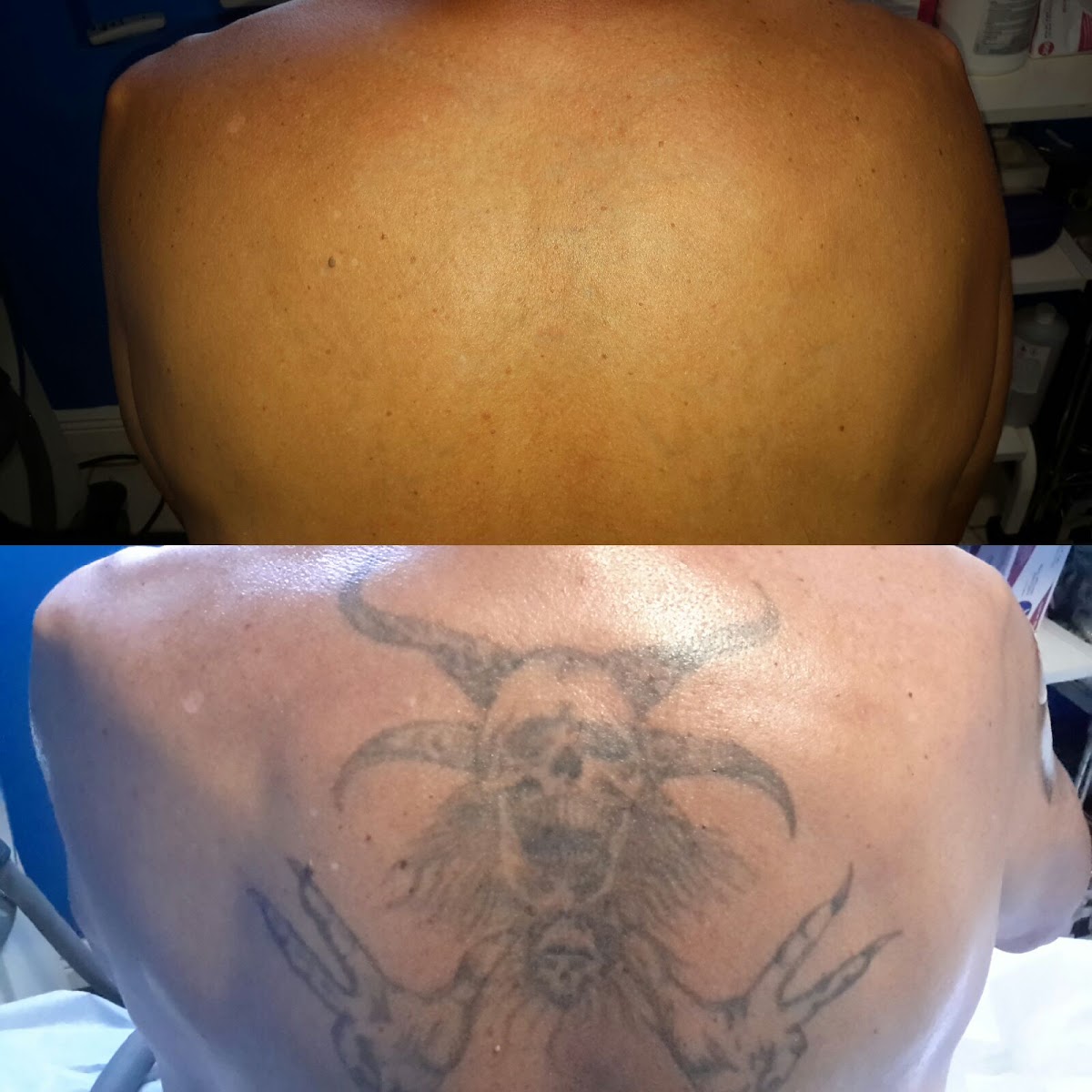 Winter Park Tattoo Removal tattoo parlor in Winter Park, FL