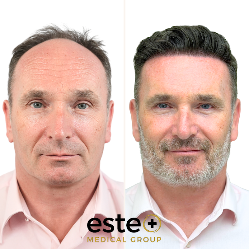 Este Medical Group- Hair & Skin Clinic Glasgow