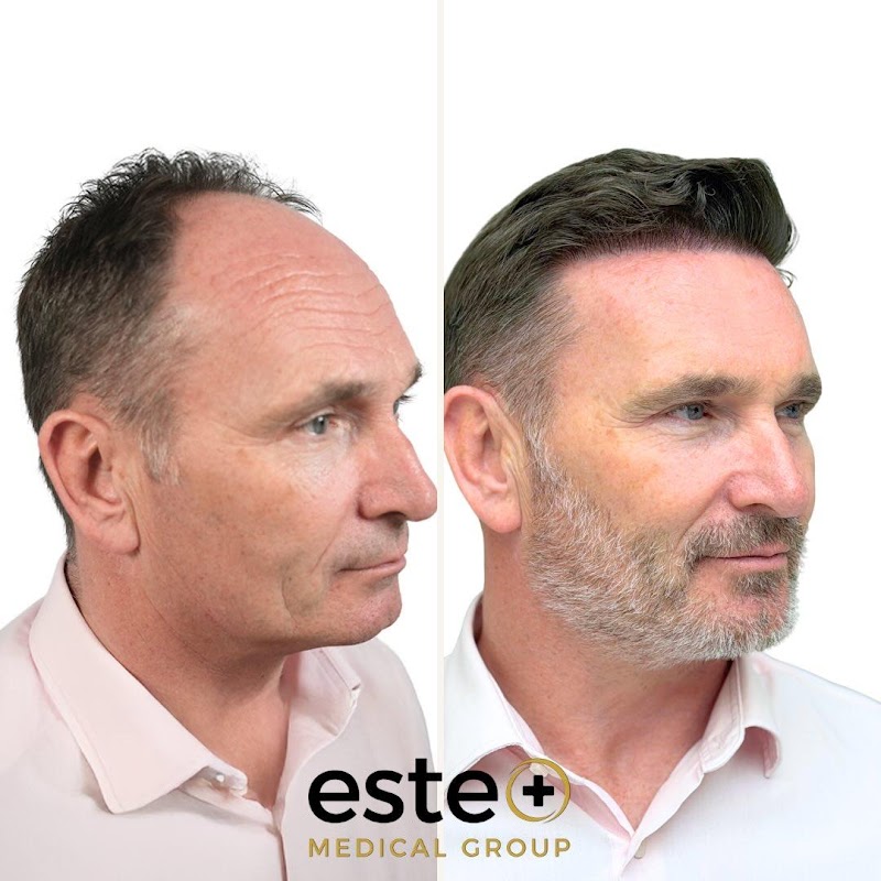 Este Medical Group- Hair & Skin Clinic Glasgow