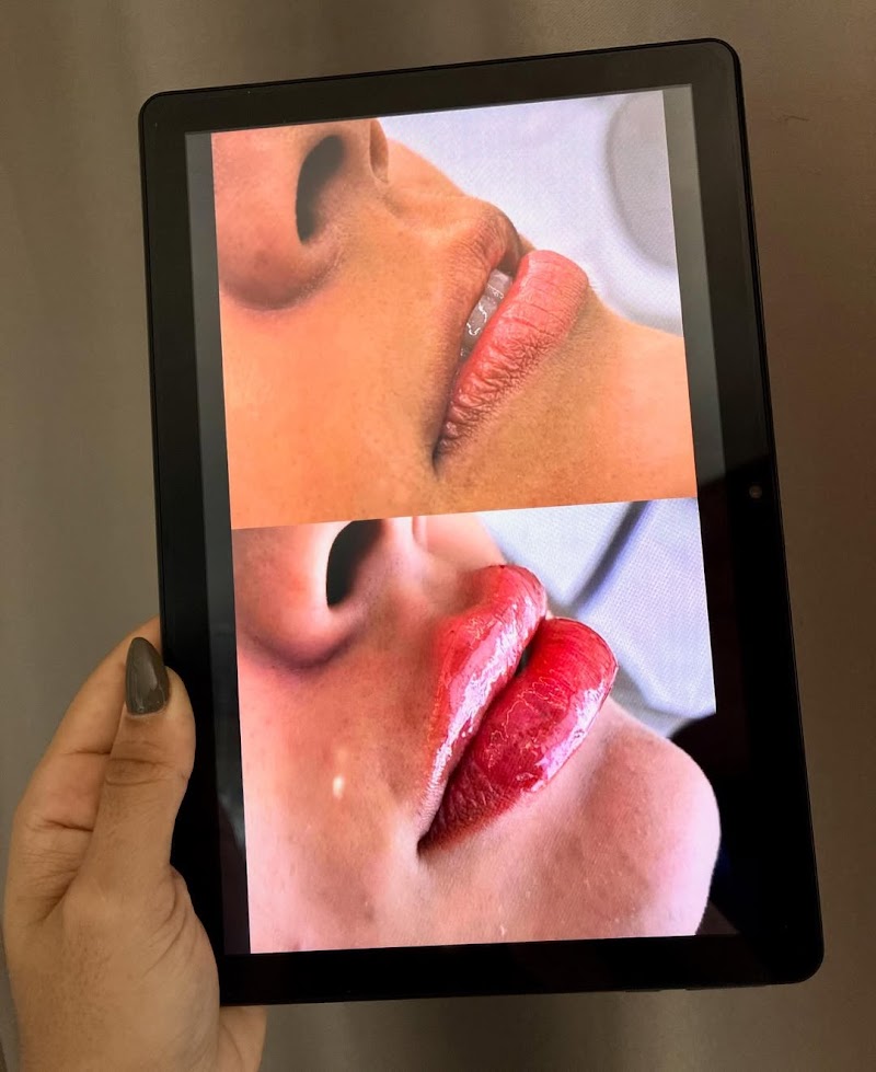 Dra. Nitelly Siqueira | Harmonização Orofacial em Fortaleza - foto 4