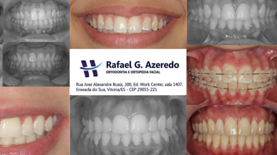 Rafael G. Azeredo Ortodontia - foto 3