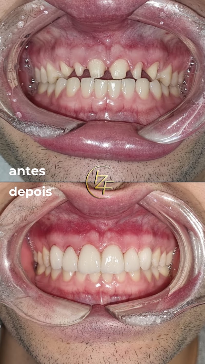 Dr. Ivan Zanatta Filgueiras - consultório odontologico com especialista em implante, periodontia e estetica oral