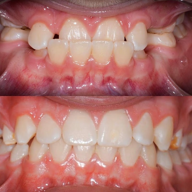 Dentista em Teresópolis I Dr. Fabiano Gabry Soluções Odontológicas I Implante em Teresópolis - foto 3