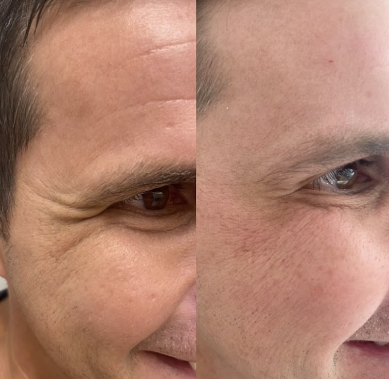 Dra Paola Brito harmonização facial - foto 4