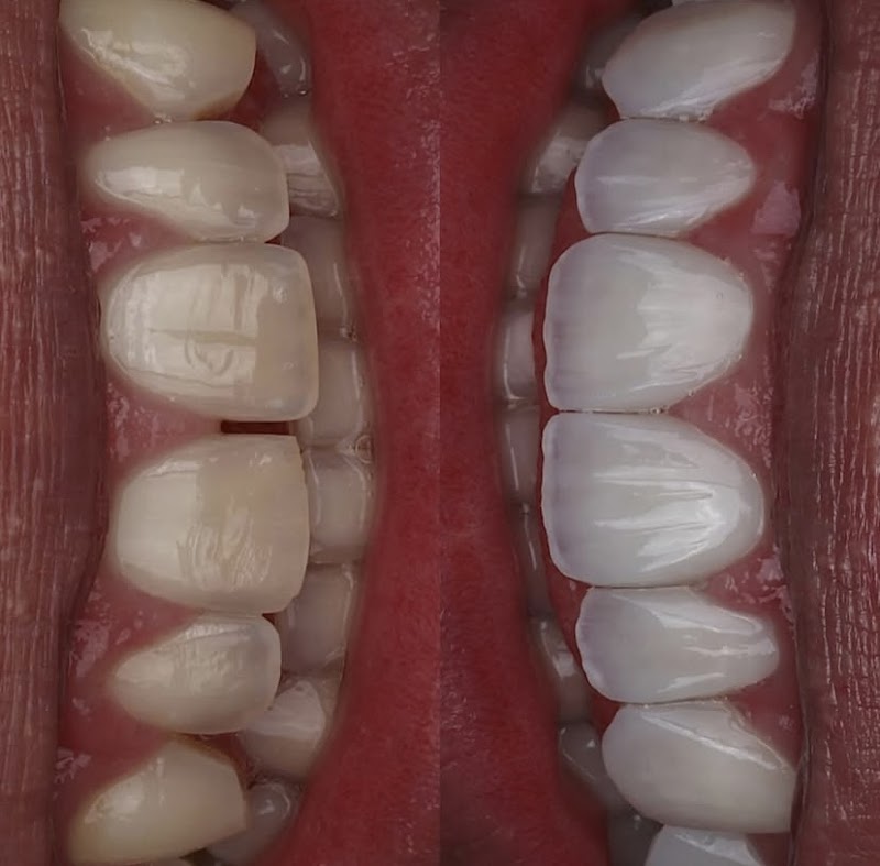 Ravivvare - Reabilitação Estética e Harmonização Orofacial - foto 4