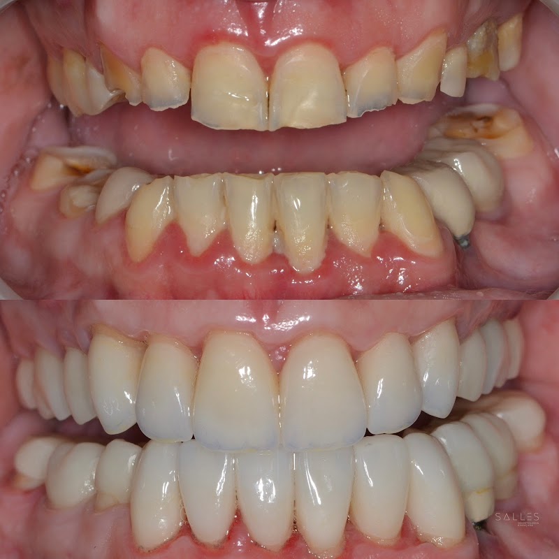 Salles Odontologia Avançada