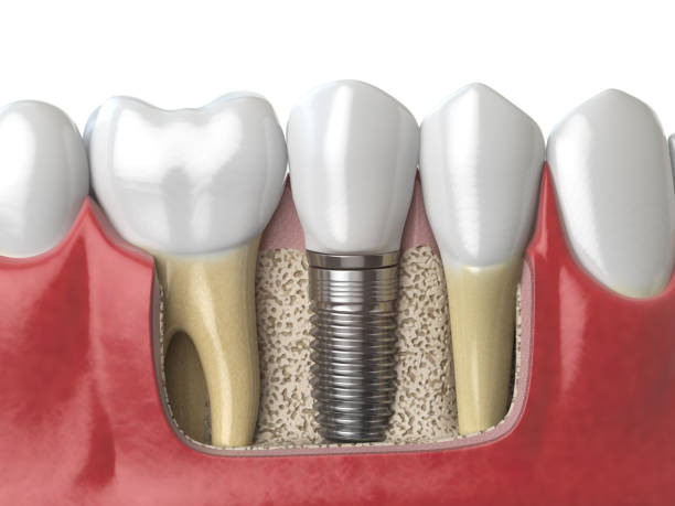 Cliniimplant Reabilitação odontológica Integrada - foto 2