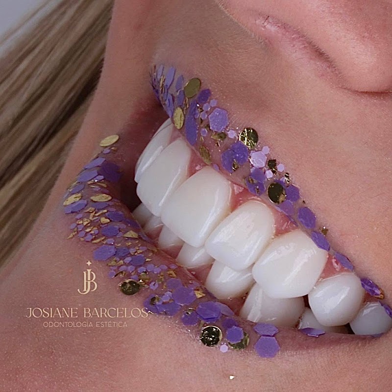 Dra Josiane Barcelos facetas de resina Nova Friburgo - foto 5