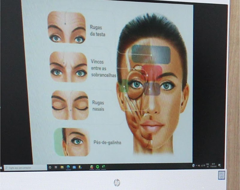 Dra. Andrea Rocha - Especialista em Ortodontia, Endodontia e Toxina Botulínica - foto 5