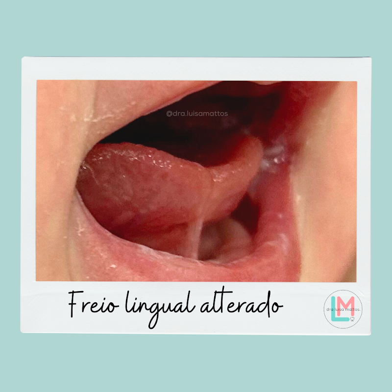 Dra Luisa Mattos - Odontopediatra - foto 4