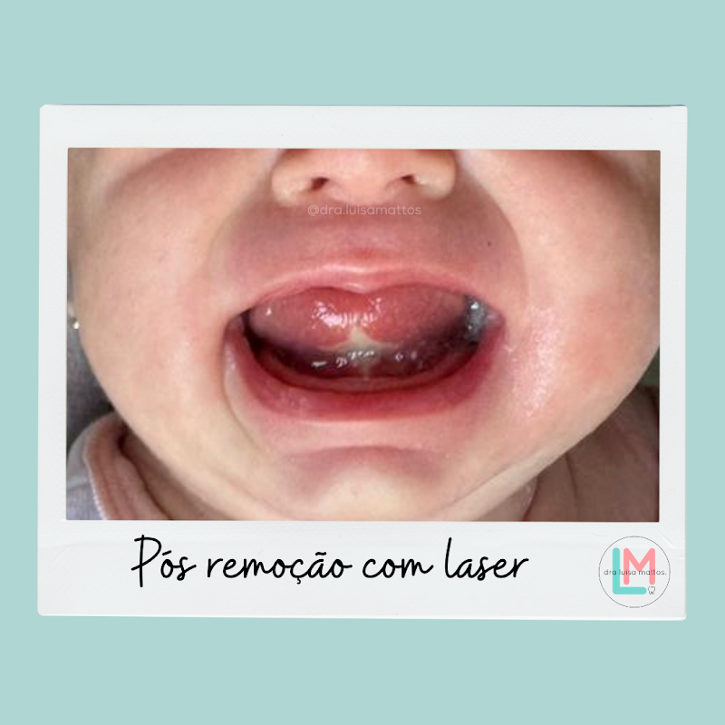 Dra Luisa Mattos - Odontopediatra - foto 5