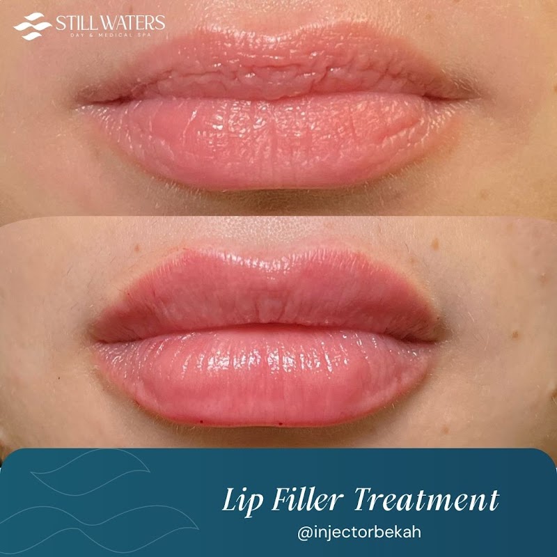 Still Waters Day & Medical Spa