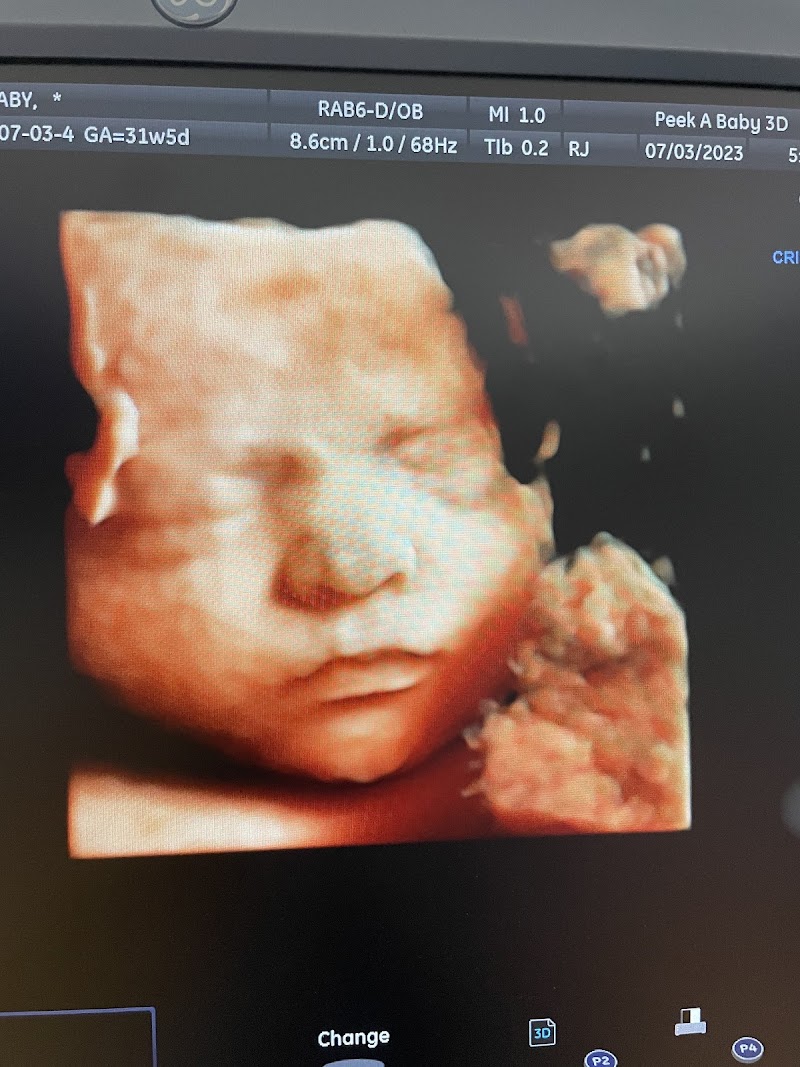 Peek A Baby 3D