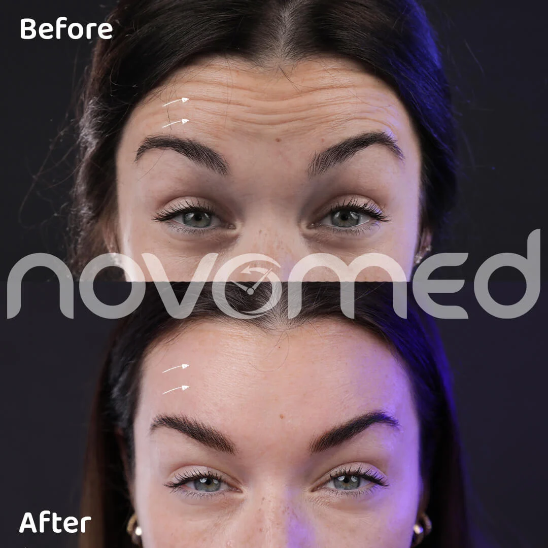 Novomed Fillers and Botox Clinic - Dubai Marina 3