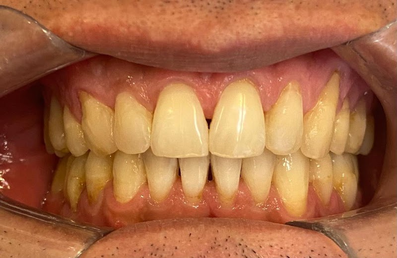 Dra. Isabela Maria Laubenstein Ortodontia Invisalign Cambuí - foto 3