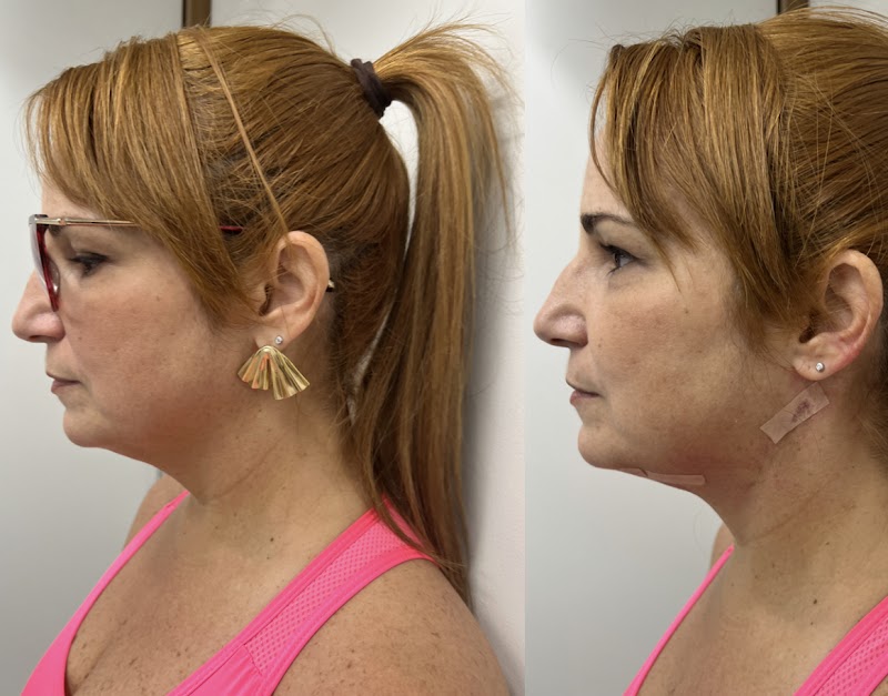 Dra. Priscila e Andrade Harmonização Facial e Ortodontia - foto 5