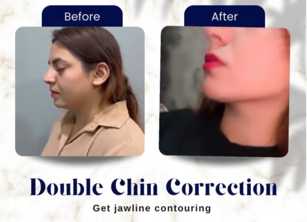 Glamorous Dubai Plastic Surgery Clinic | Liposuction, Rhinoplasty, BBL, Abdominoplasty, Blepharoplasty, Breast Implants 2