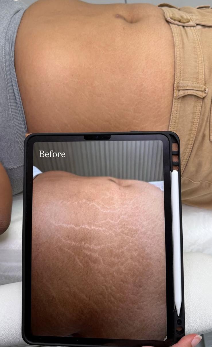 Glamorous Dubai Plastic Surgery Clinic | Liposuction, Rhinoplasty, BBL, Abdominoplasty, Blepharoplasty, Breast Implants 3