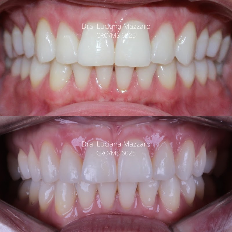 Dra Luciana Mazzaro - Ortodontia/Invisalign - foto 2
