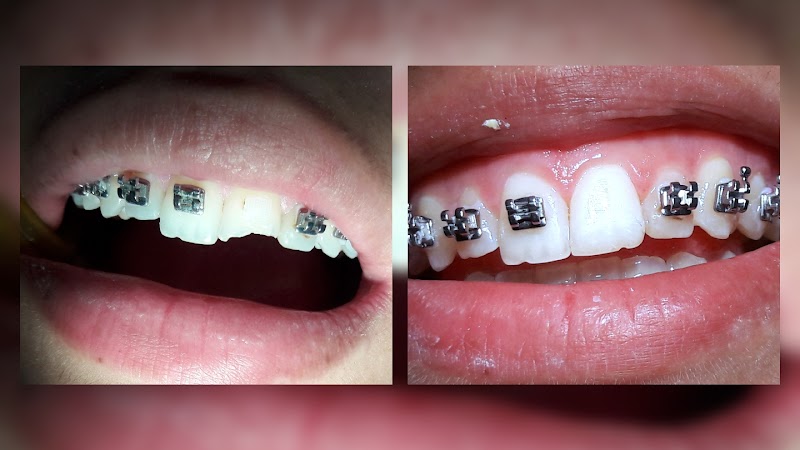 Dra Denise Angelini Silva