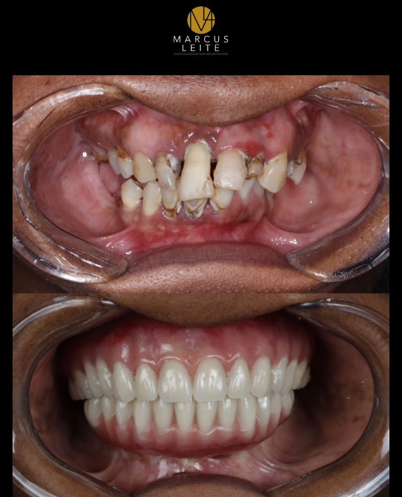 Studio Oralmax Odontologia | Dentista Itaigara | Dentista na Pituba | Dentista Em salvador - foto 4