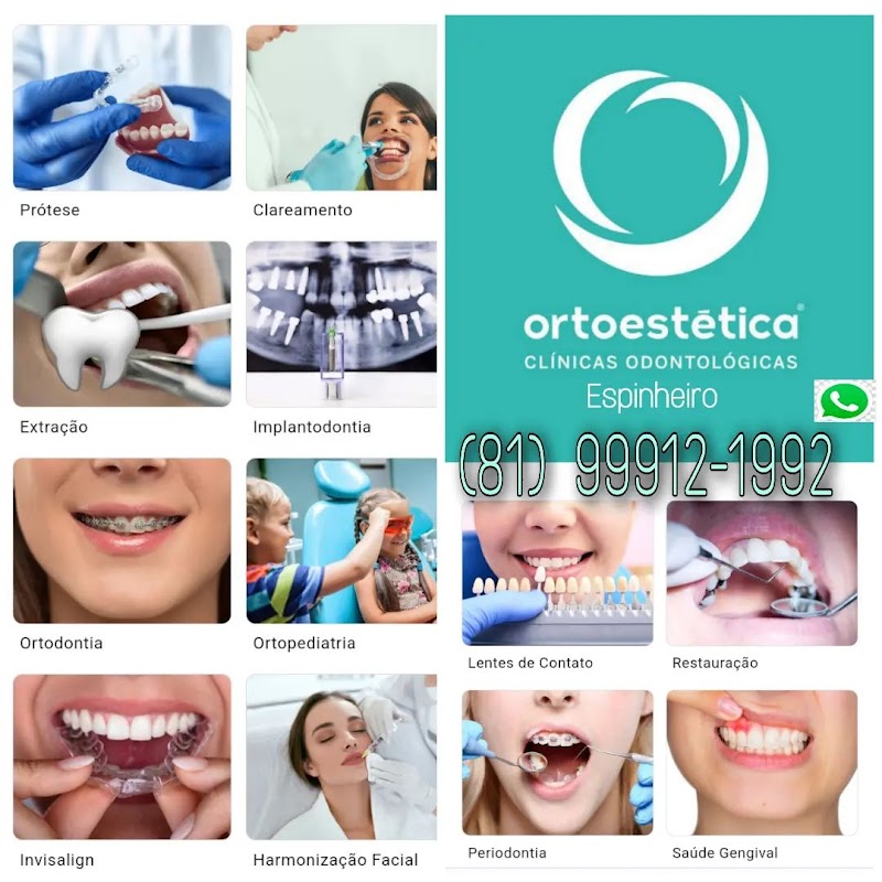 Ortoestética Espinheiro: Harmonização Facial, Clareamento Dental, Recife PE - foto 4