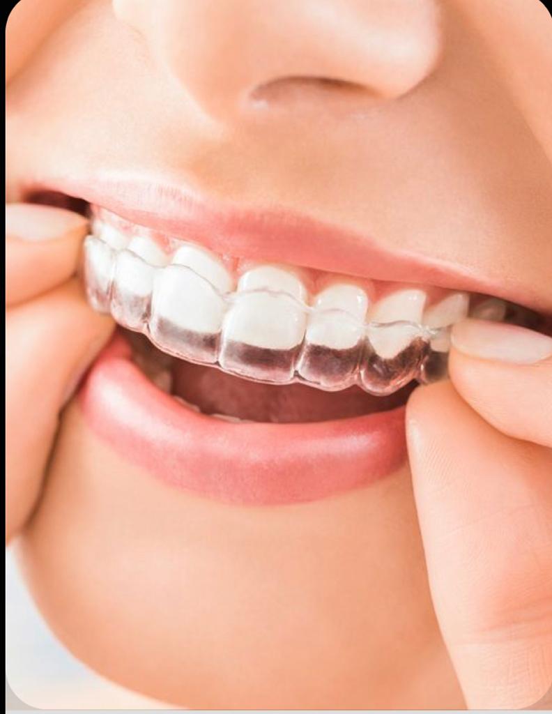 Dra. Mônica Casimiro Ortodontia Alinhadores Harmonização Facial