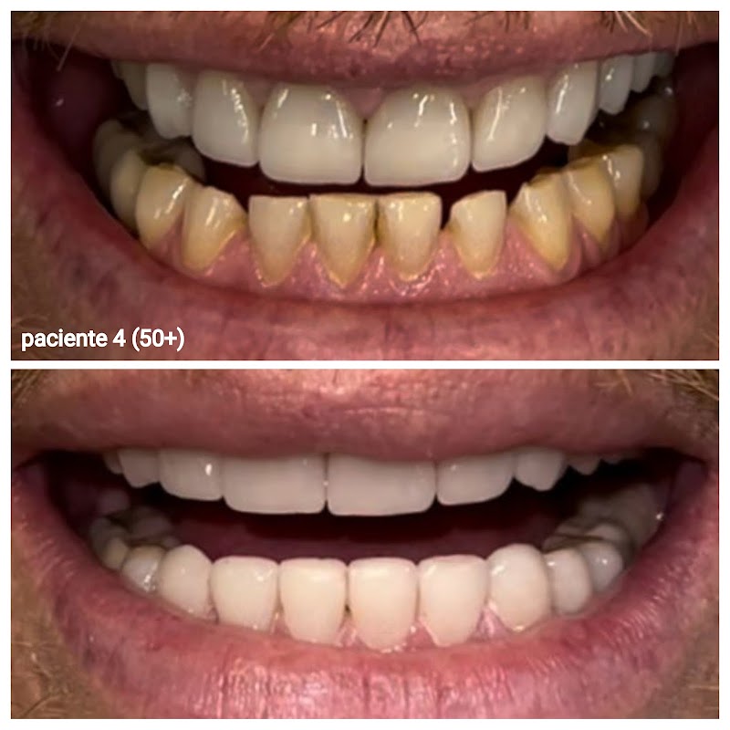 Consultório Dra. Márcia Cuenca/ImplantareOdontoClinic - foto 4