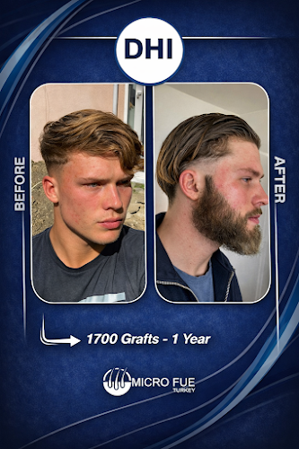 Hair Transplant Izmir I Micro Fue Turkey logo