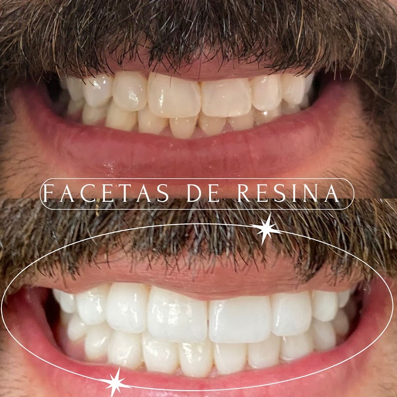 Odonto Cristal - foto 2