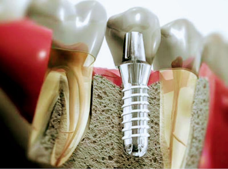 Dr. GLEISSON R. A. MARQUES - foto 5