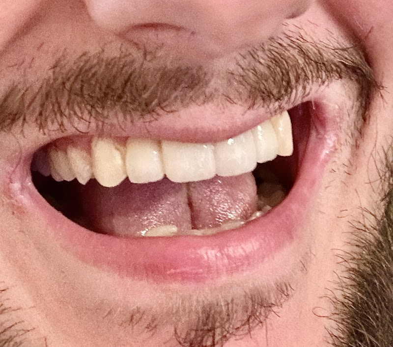 Godt Smil Tandlægerne Vejle - billede 6