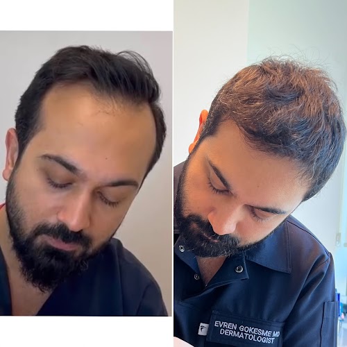 Dr.Gökeşme Hair Transplant logo