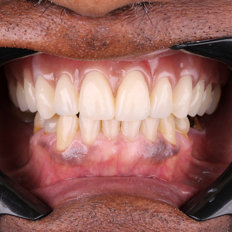 Dra. Claudia Schiffler/Implante Dental - foto 2