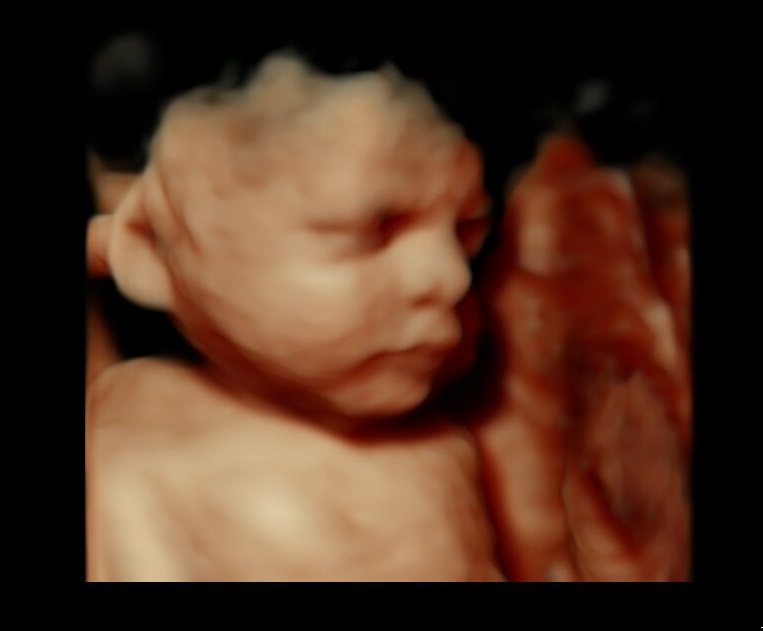 Cherished Memories 3D 4D Ultrasound