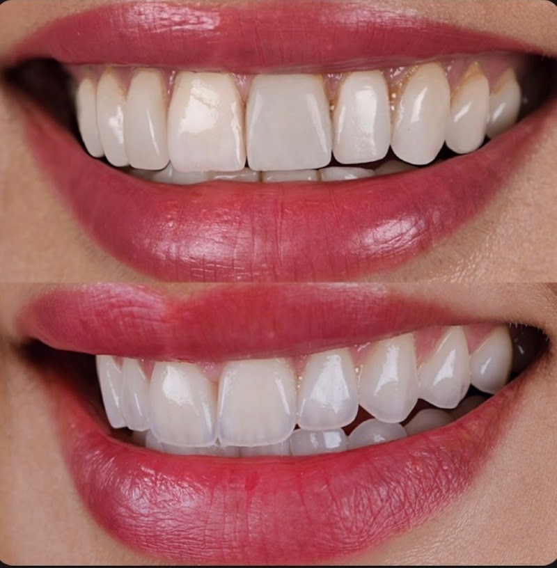 Clínica Boutique Dra. Fabiana Dantas | Implantes Dentários em Teresina | Lentes de Contato Dental | Harmonização Facial - foto 3