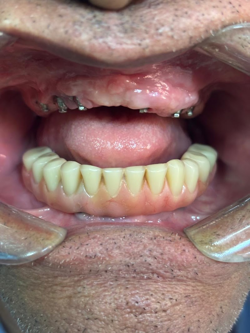 Dentista Popular do Brasil Unidade Retiro - foto 5