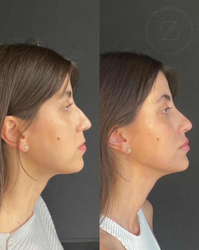 Dra. Lara Zanatta - Odontologia e Harmonização Orofacial - foto 4