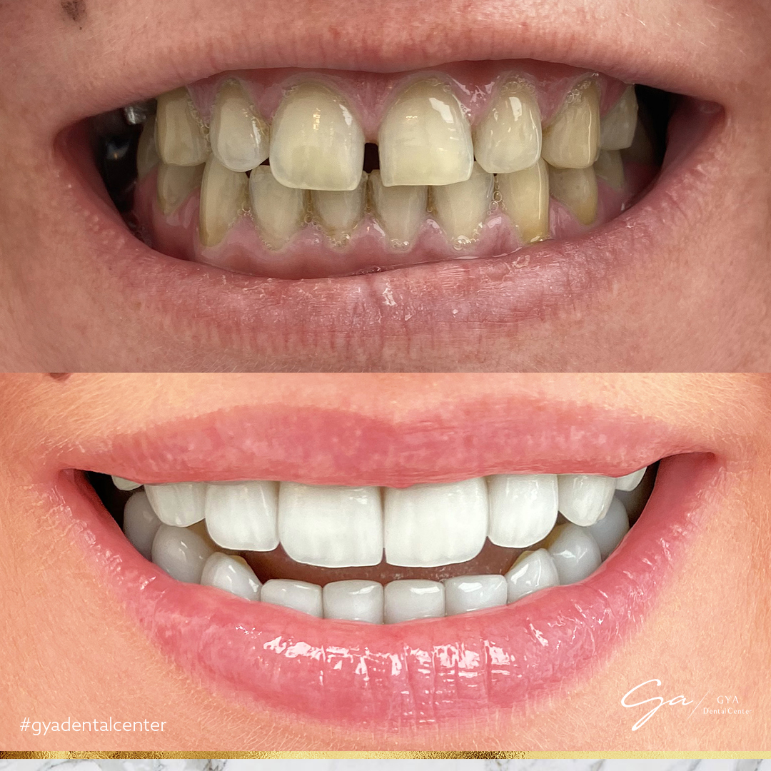 GYA dental center 4