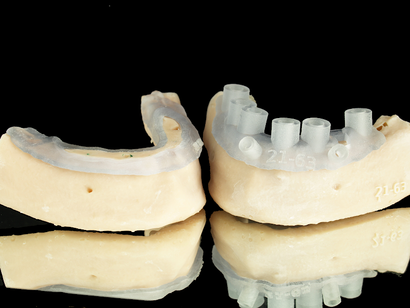 LABORATORIO DENTAL SALNES (ODONTOLOGÍA DIGITAL) photo 1